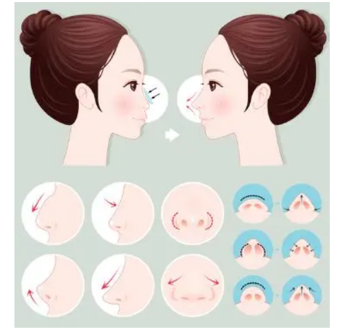 微信截图_20230330170235.png