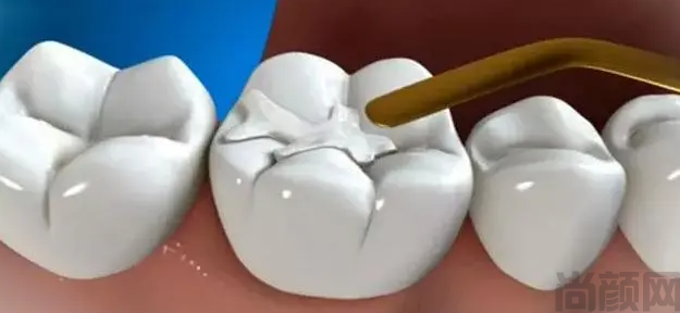 微信截图_20230407153425.png