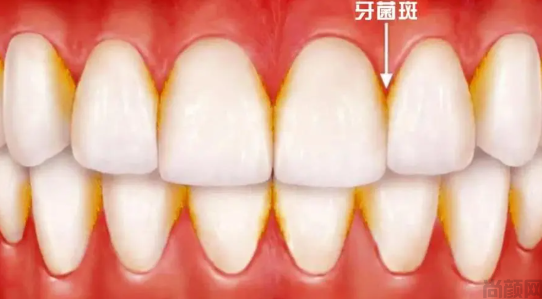 微信截图_20230411105819.png