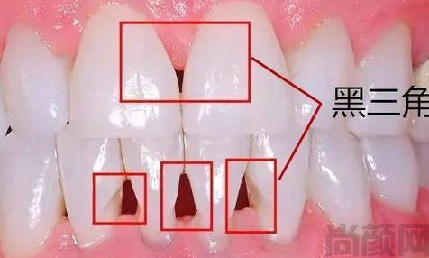 微信截图_20230411115526.png