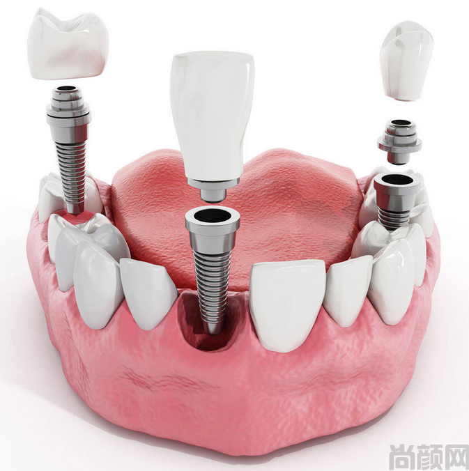 微信截图_20230407180601.png