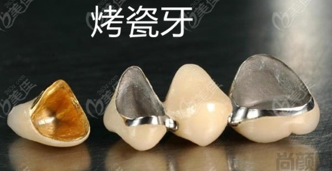 镍铬烤瓷牙致癌案例与原因！如何预防镍铬烤瓷牙致癌