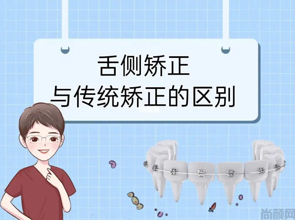 舌侧矫正和传统矫正哪个效果好?两种矫正方法进行比较分析