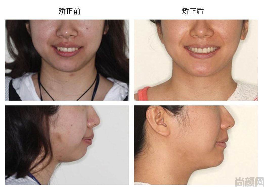 微信截图_20230417145606.png