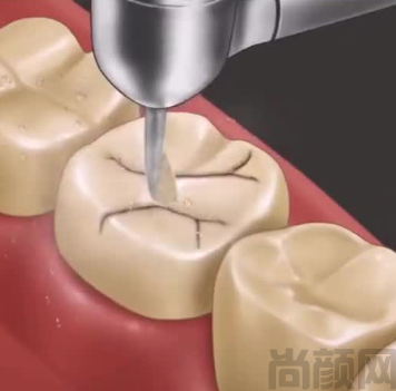 微信截图_20230417104525.png