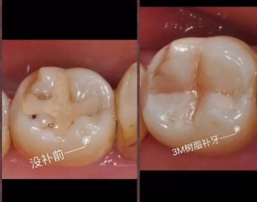 省口腔医院收费价目表抢先看:种牙/拔牙/补牙价格都有