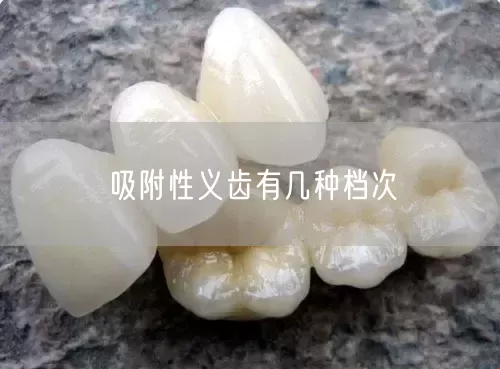 吸附性义齿有几种档次?我们该怎么来选择(图1)