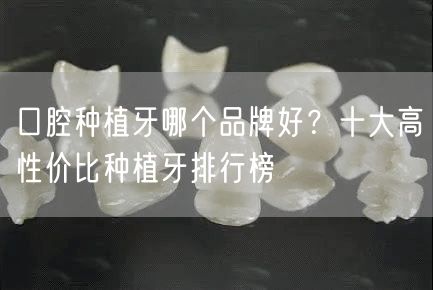 口腔种植牙哪个品牌好？十大高性价比种植牙排行榜
