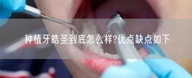 种植牙皓圣到底怎么样?优点缺点如下