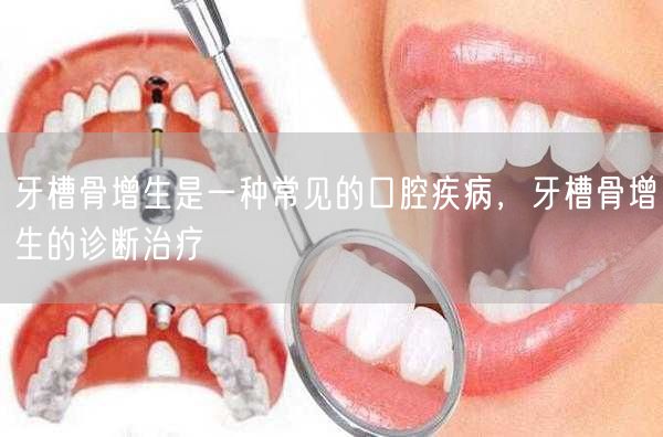 牙槽骨增生是一种常见的口腔疾病，牙槽骨增生的诊断治疗