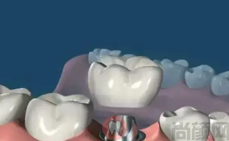 微信截图_20230419143710.png