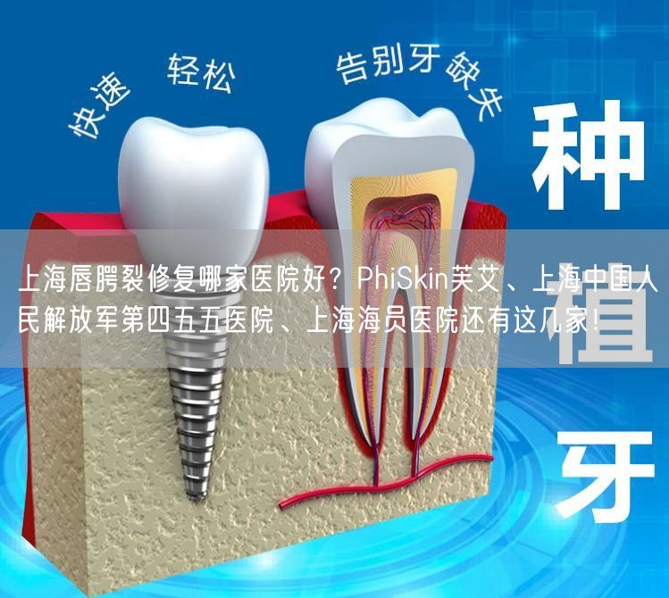上海唇腭裂修复哪家医院好？PhiSkin芙艾、上海中国人民解放军第四五五医院、上海海员医院还有这几家！