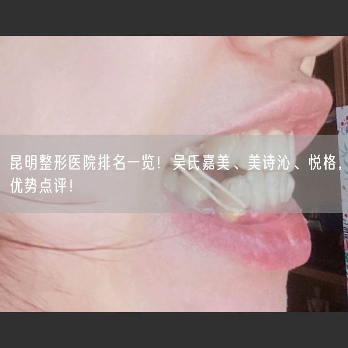 昆明整形医院排名一览！吴氏嘉美、美诗沁、悦格，优势点评！