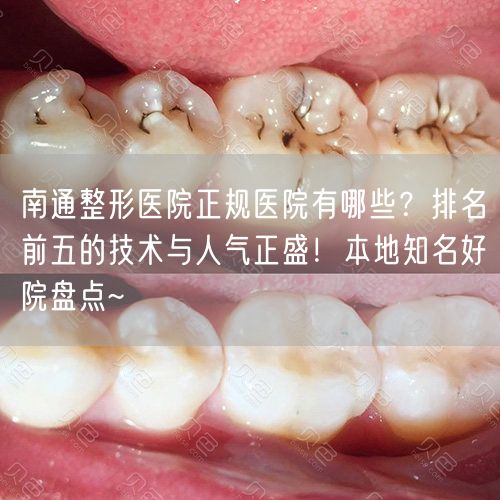 南通整形医院正规医院有哪些？排名前五的技术与人气正盛！本地知名好院盘点~