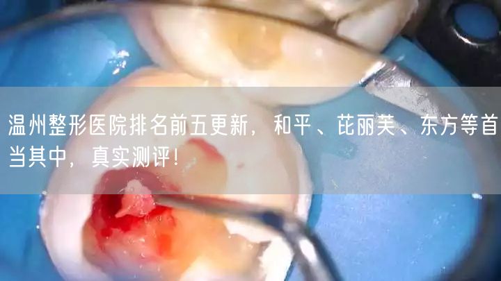 温州整形医院排名前五更新，和平、芘丽芙、东方等首当其中，真实测评！