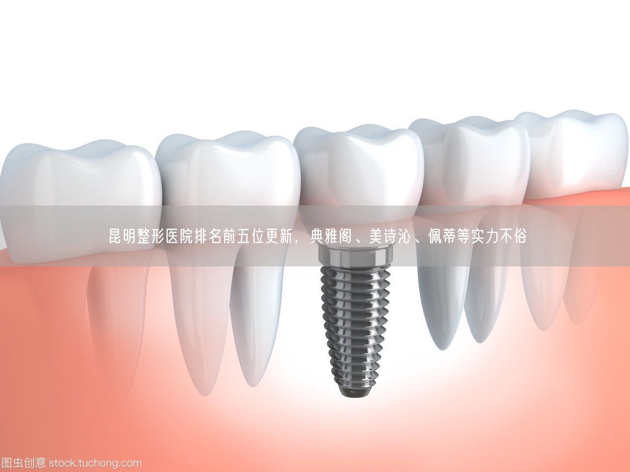 昆明整形医院排名前五位更新，典雅阁、美诗沁、佩蒂等实力不俗