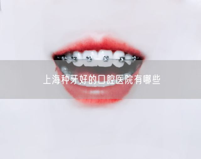 上海种牙好的口腔医院有哪些