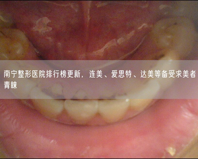 南宁整形医院排行榜更新，连美、爱思特、达美等备受求美者青睐