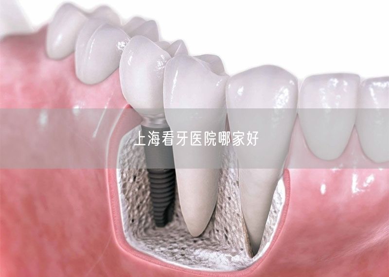上海看牙医院哪家好