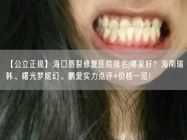 【公立正规】海口唇裂修复医院排名|哪家好？海南瑞韩、曙光梦妮幻、鹏爱实力点评+价格一览！