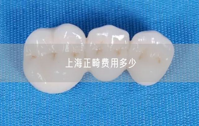 上海正畸费用多少