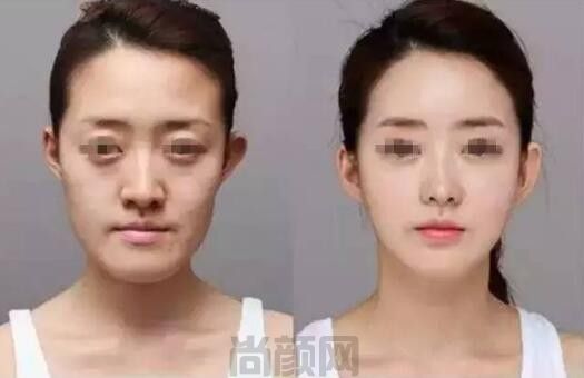 绵阳整形美容医院排名前六位：四川朗睿、华美紫馨引领医美新风潮！医院资料get(图4)