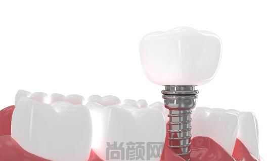 小白兔吉祥口腔种植牙价格全新发布,不仅技术好收费还惹人爱