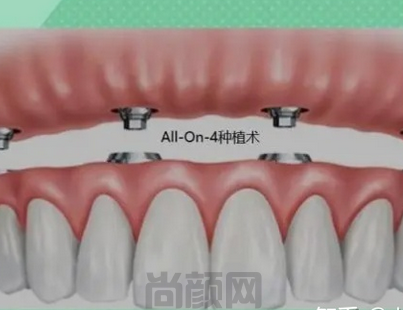 截图20230617192834.png