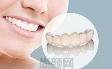 顺德壹加壹口腔医院种植牙价格要多少钱?看这篇指南就够了!