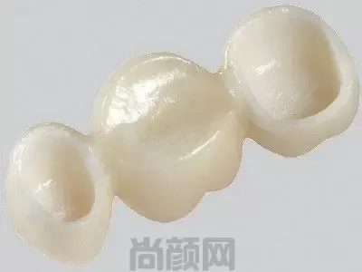 分享2023全瓷牙套价格表明细,全瓷牙真的有这么贵吗