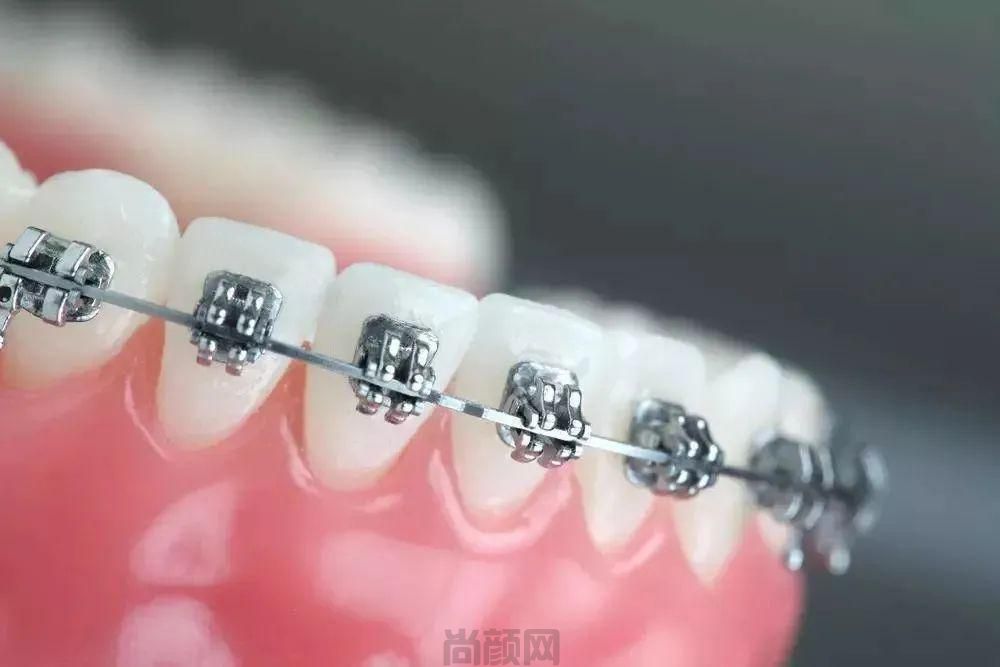 免费咨询牙科医生:24小时口腔医生回答关于种牙/牙齿矫正等口腔问题