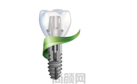 中诺口腔医院种植牙收费高吗?看中诺口腔种牙收费明细及补贴政策