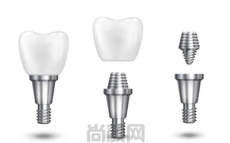 2023做一颗种植牙多少钱，在这查看种植牙价格表看牙不迷路~
