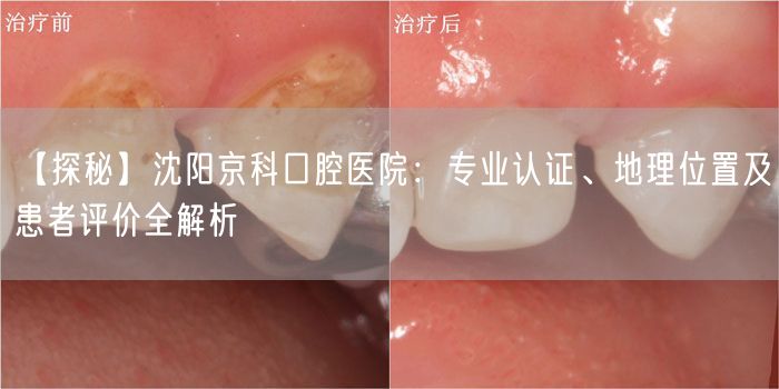 【探秘】沈阳京科口腔医院：专业认证、地理位置及患者评价全解析(图1)