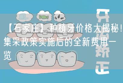 【石家庄】种植牙价格大揭秘！集采政策实施后的全新费用一览
