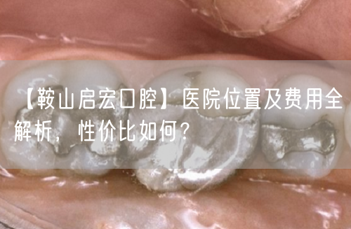 【鞍山启宏口腔】医院位置及费用全解析，性价比如何？(图1)