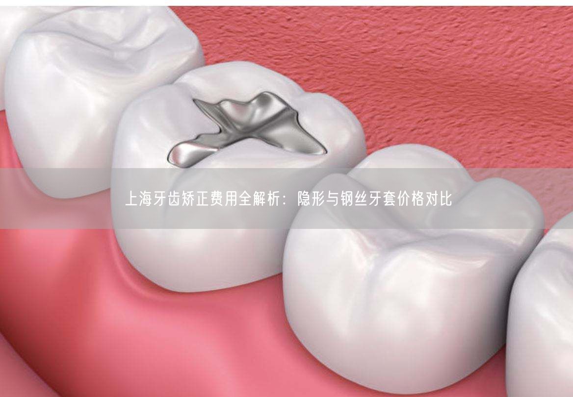 上海牙齿矫正费用全解析：隐形与钢丝牙套价格对比