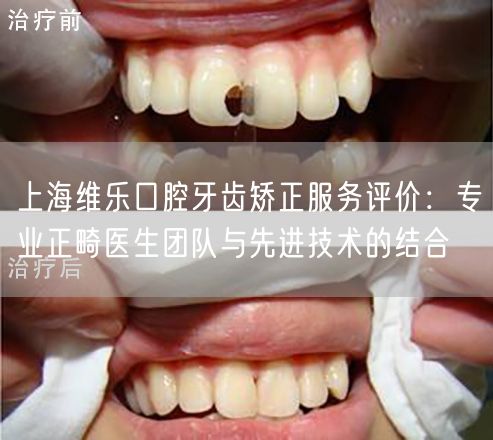 上海维乐口腔牙齿矫正服务评价：专业正畸医生团队与先进技术的结合