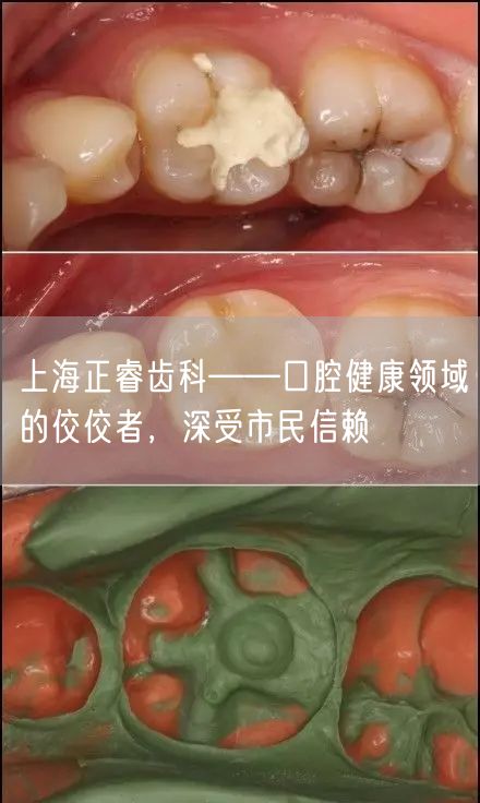 上海正睿齿科——口腔健康领域的佼佼者，深受市民信赖