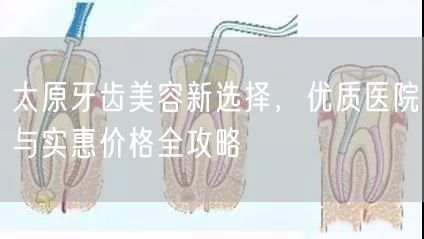 太原牙齿美容新选择，优质医院与实惠价格全攻略