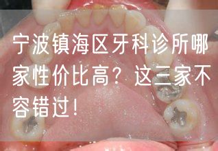 宁波镇海区牙科诊所哪家性价比高？这三家不容错过！