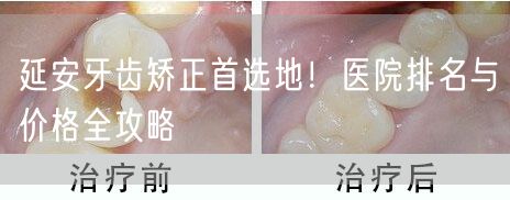 延安牙齿矫正首选地！医院排名与价格全攻略