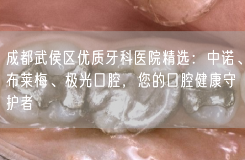 成都武侯区优质牙科医院精选：中诺、布莱梅、极光口腔，您的口腔健康守护者(图1)