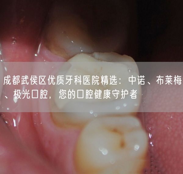 成都武侯区优质牙科医院精选：中诺、布莱梅、极光口腔，您的口腔健康守护者