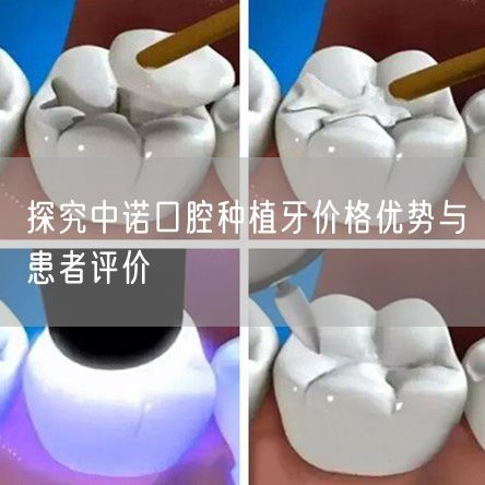 探究中诺口腔种植牙价格优势与患者评价