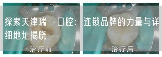 探索天津瑞璟口腔：连锁品牌的力量与详细地址揭晓
