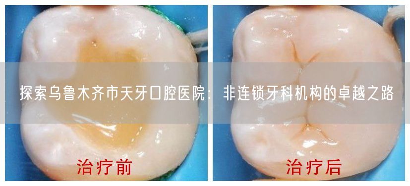 探索乌鲁木齐市天牙口腔医院：非连锁牙科机构的卓越之路(图1)