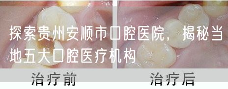 探索贵州安顺市口腔医院，揭秘当地五大口腔医疗机构(图1)