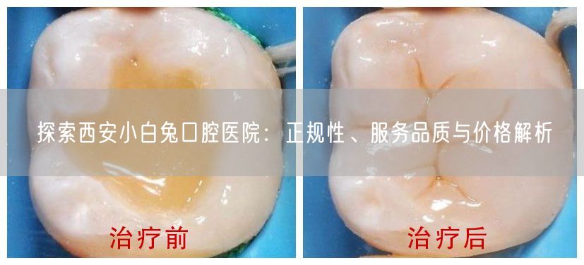 探索西安小白兔口腔医院：正规性、服务品质与价格解析