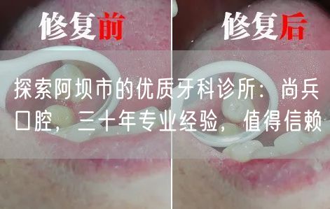 探索阿坝市的优质牙科诊所：尚兵口腔，三十年专业经验，值得信赖